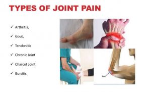 Joint_Pain